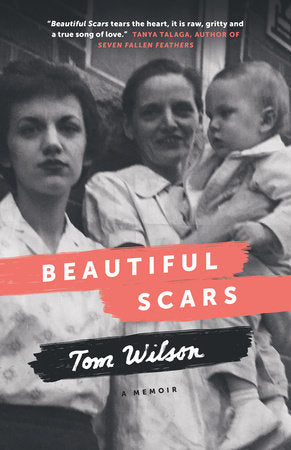 Beautiful Scars Paperback by Tom Wilson