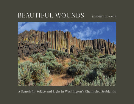 Beautiful Wounds Hardcover by Timothy Connor